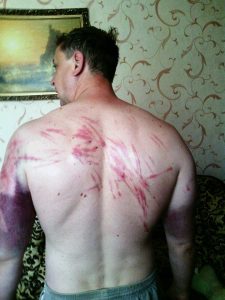 Pastor Sergey after being tortured
