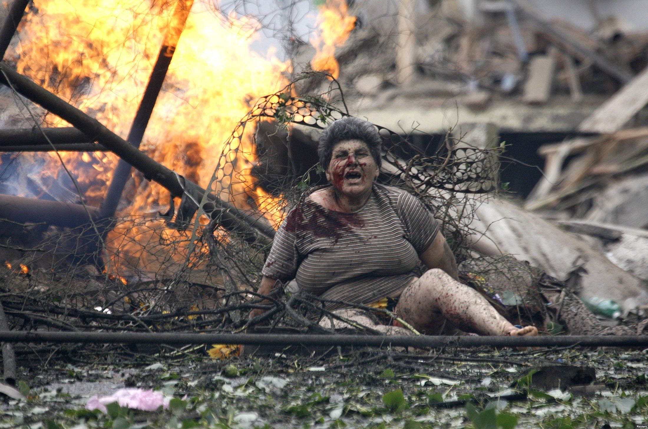 Russian invasion in Georgia in August 2008. A wounded Georgian woman in the town of Gori, 80 km (50 miles) from Tbilisi. (Image: Reuters)