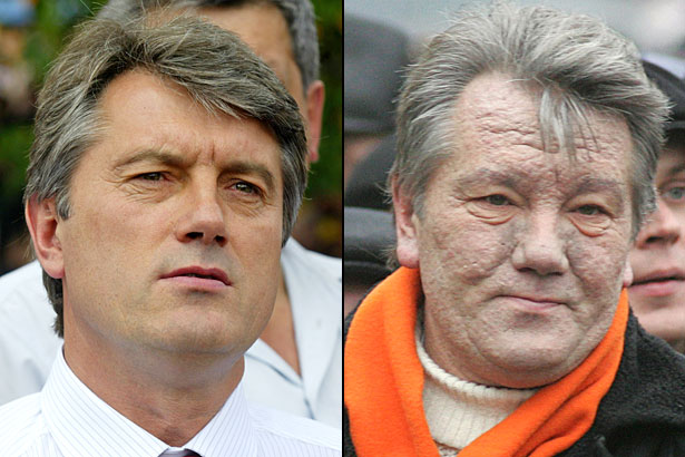 Viktor Yushchenko before and after poisoning. Reuters file photos