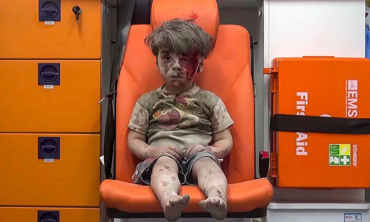 This boy's name is Omran. His family's house in Aleppo was hit by one of the Russian bombs that flatten everything within their kill zone. Aleppo, Syria, August 2016 (Photo: Mahmoud Rislan)