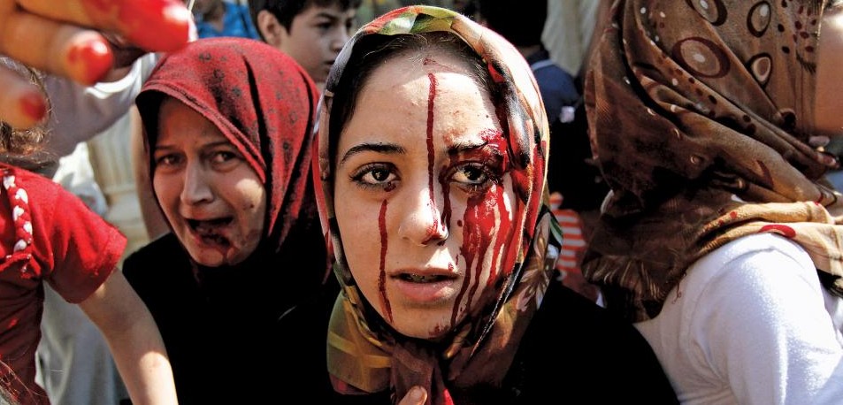 A wounded Syrian woman arrives at a field hospital following an air strike which hit her home in the town of Azaz, on the outskirts of Aleppo. (Image: Khalil Hamra/AP)