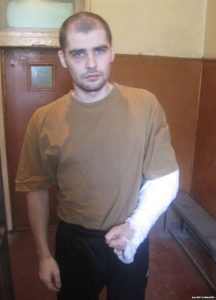 Oleksandr Kostenko with broken arm ~