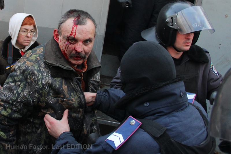 18.02.2014 | Detention of wounded demonstrators after clashes with police in central Kyiv. Photo by Viktor Gurniak ~