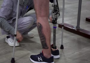 Prostheses of Ukrainian serviceman Dmytro