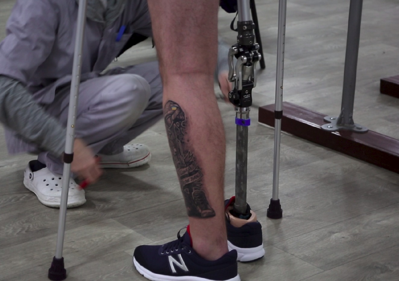 Stylish Prosthetic Limbs Boost Amputees' Quality of Life