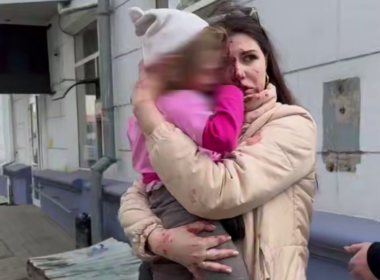 injured child after russian attacks