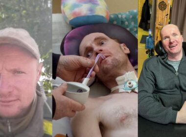 Ukrainian soldier Vitalii Shumey before his serious head injury during a combat mission (left), first months after the injury (middle) he was paralyzed and almost unresponsive, and now in 2025 Vitalii began talking in short sentences, moving a little bit and eating by himself.