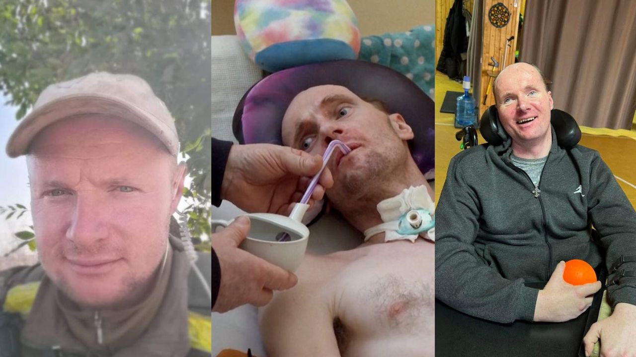 Ukrainian soldier Vitalii Shumey before his serious head injury during a combat mission (left), first months after the injury (middle) he was paralyzed and almost unresponsive, and now in 2025 Vitalii began talking in short sentences, moving a little bit and eating by himself.