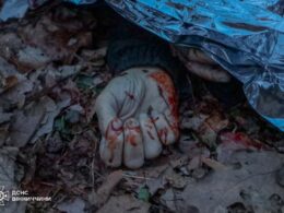 A victim of the largest Russian drone attack on 25 March 2026. Source: DSNS