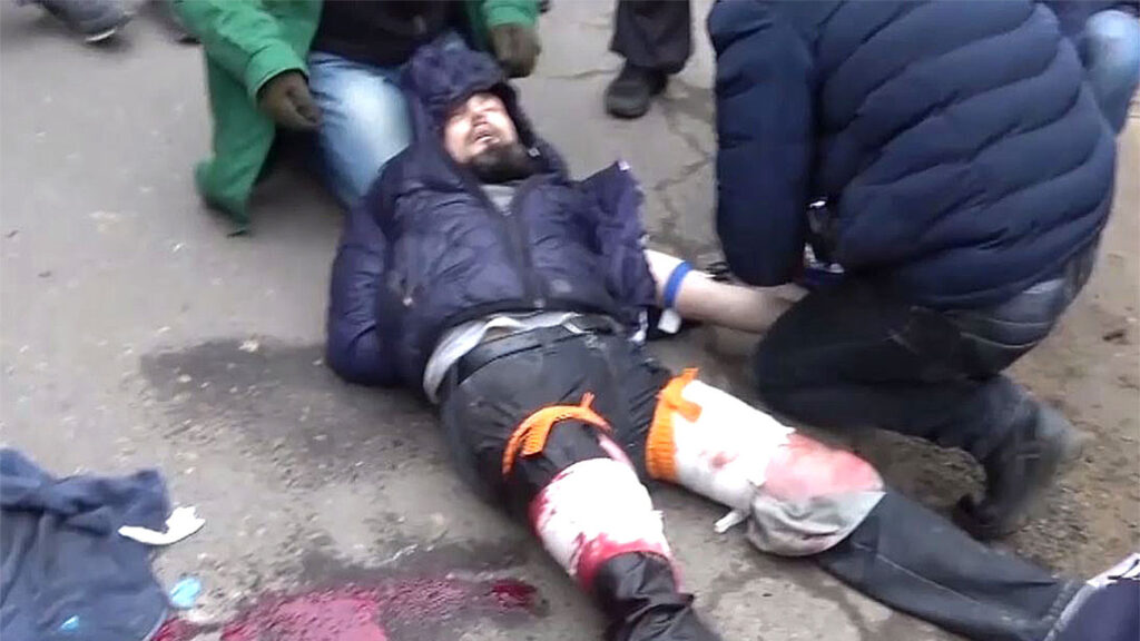 Vital Melnik was shot in the legs during detention. Photo: t.me/sewerfsefsd