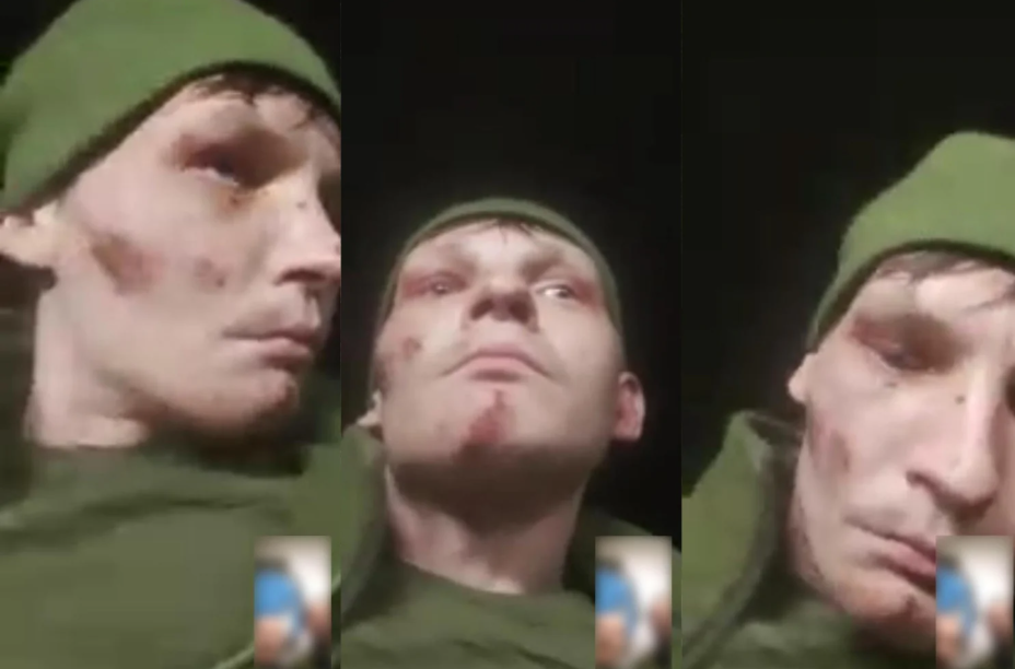 Visible injuries on the face of one of the soldiers. Photo: Personal archives / Babel