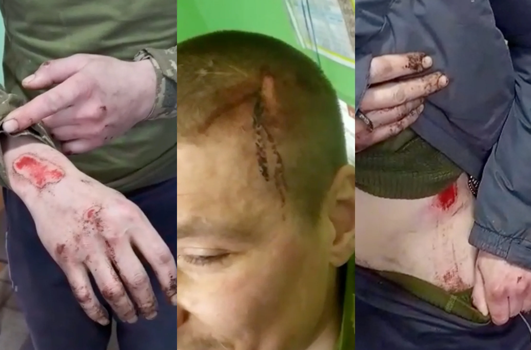 Injuries sustained by Oleksandr Semenov.